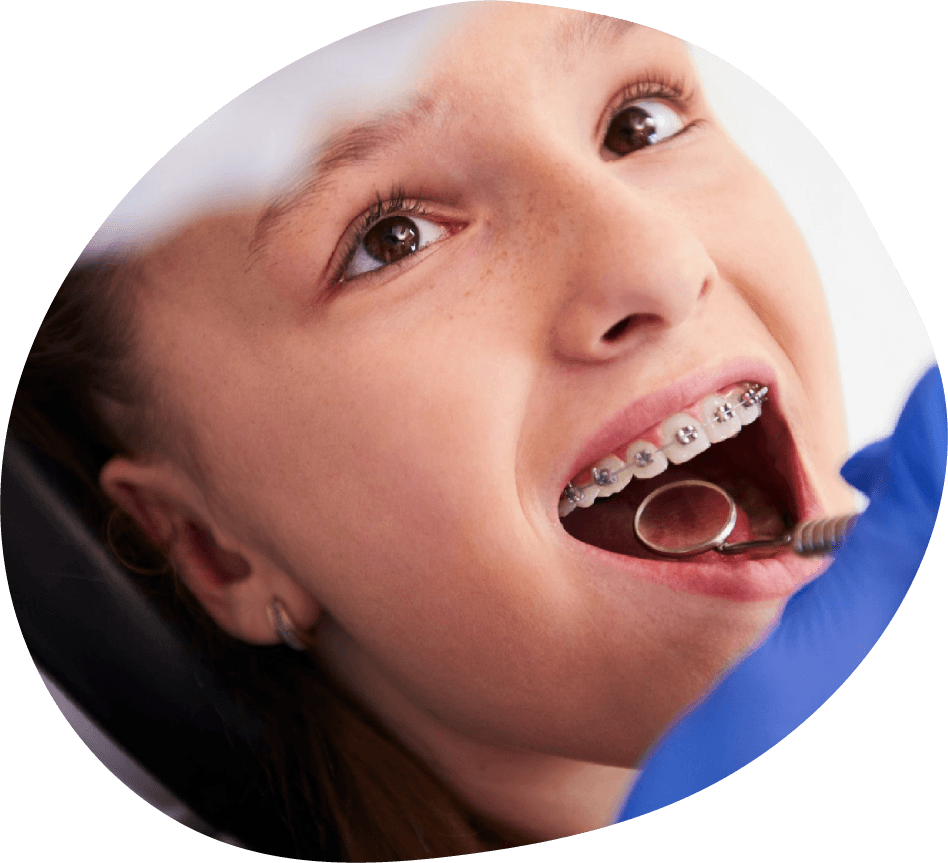 //maissasmile.com/wp-content/uploads/2023/11/Orthodontie-8-2.png